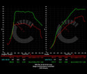 BMW X3M/X4M 703 HP Stage 2 Performance Controller